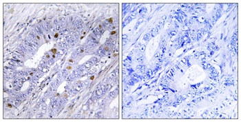 Nur77 rabbit pAb Antibody