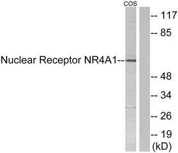 Nur77 rabbit pAb Antibody