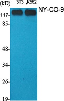 NY-CO-9 rabbit pAb Antibody