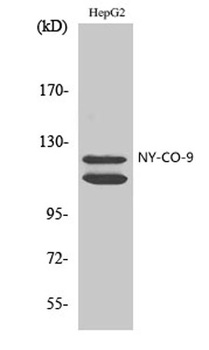 NY-CO-9 rabbit pAb Antibody