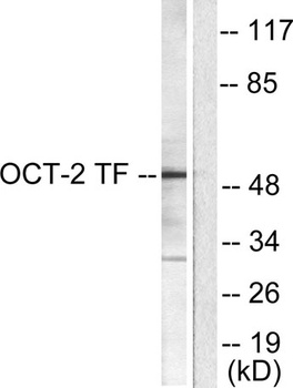 Oct-2 rabbit pAb Antibody
