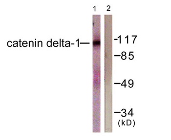 p120 rabbit pAb Antibody