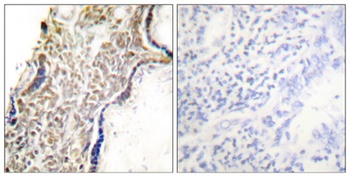 p14 rabbit pAb Antibody