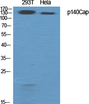 p140Cap rabbit pAb Antibody