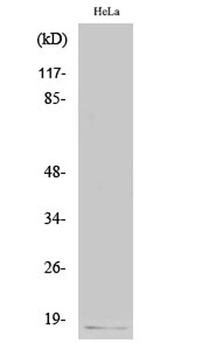 p16 rabbit pAb Antibody