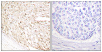 p18 rabbit pAb Antibody