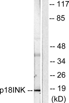 p18 rabbit pAb Antibody