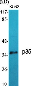 p35 rabbit pAb Antibody