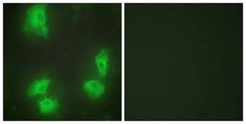 p35 rabbit pAb Antibody