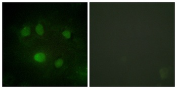 p68 RNA Helicase rabbit pAb Antibody