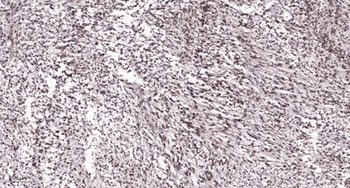 PAF65α rabbit pAb Antibody