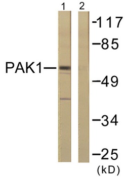 PAKα rabbit pAb Antibody