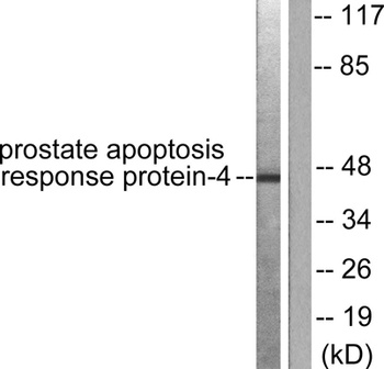 PAR4 rabbit pAb Antibody