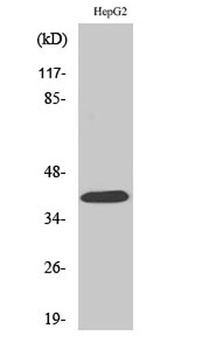 PAR-4 rabbit pAb Antibody