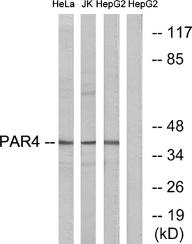 PAR-4 rabbit pAb Antibody