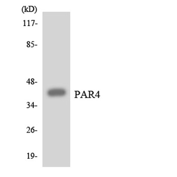 PAR-4 rabbit pAb Antibody