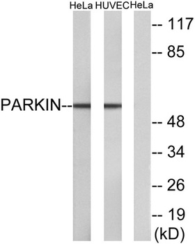 Parkin rabbit pAb Antibody