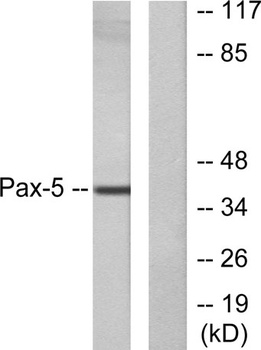 Pax-5 rabbit pAb Antibody
