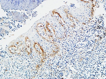 Pax-8 rabbit pAb Antibody