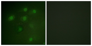 Pdcd-4 rabbit pAb Antibody