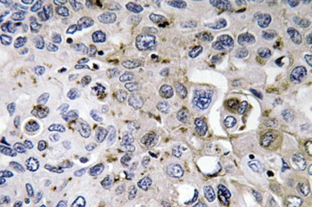 PDGF-A rabbit pAb Antibody