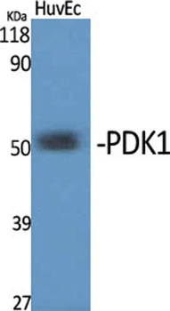 PDK1 rabbit pAb Antibody