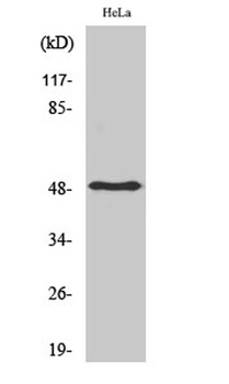 PDK1 rabbit pAb Antibody