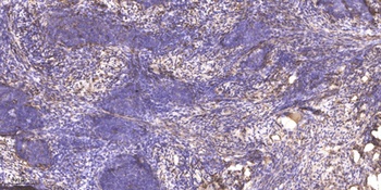 PDK1 rabbit pAb Antibody
