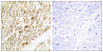 PEBP2β rabbit pAb Antibody