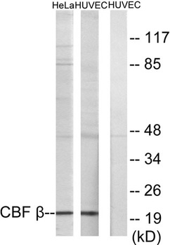 PEBP2β rabbit pAb Antibody