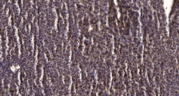 Peroxin 11β rabbit pAb Antibody
