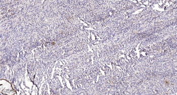 PGE synthase rabbit pAb Antibody