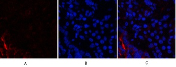 PI 3-kinase p85α/γ rabbit pAb Antibody