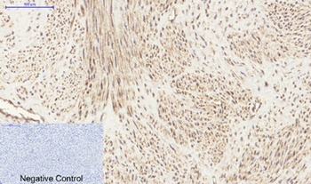 PI 3-kinase p85α/γ rabbit pAb Antibody