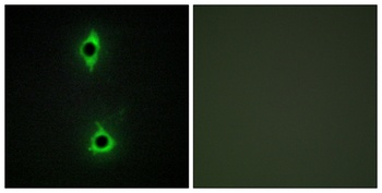 PIP5KIII rabbit pAb Antibody