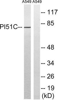 PIPK I γ rabbit pAb Antibody