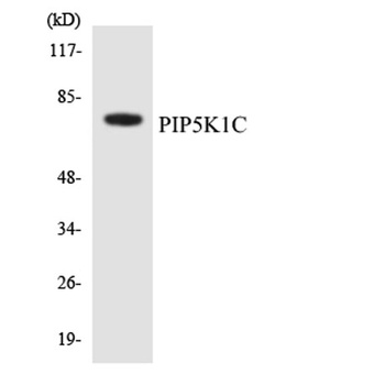 PIPK I γ rabbit pAb Antibody