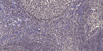 PKA Iα reg rabbit pAb Antibody