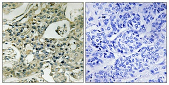 PKA Iβ reg rabbit pAb Antibody