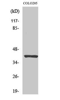 PKAα/β cat rabbit pAb Antibody