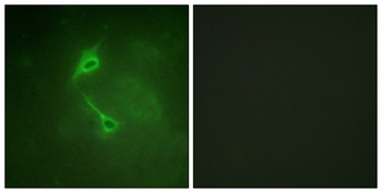 PKC ζ rabbit pAb Antibody