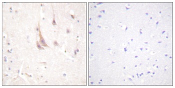 PKC ζ rabbit pAb Antibody