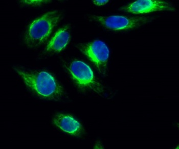 PKD1 rabbit pAb Antibody