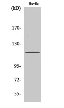 PKD1 rabbit pAb Antibody
