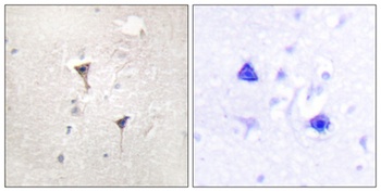 PKD1 rabbit pAb Antibody