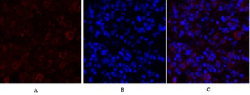 PKM2 rabbit pAb Antibody