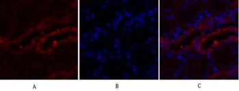 PKM2 rabbit pAb Antibody