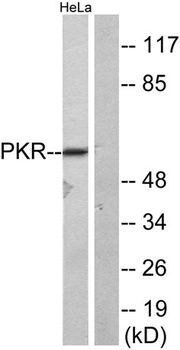 PKR rabbit pAb Antibody