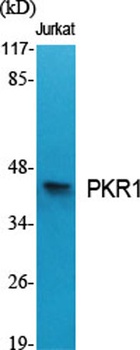 PKR1 rabbit pAb Antibody