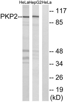 Plakophilin 2 rabbit pAb Antibody